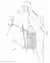 Fig. 02 - Patient lifting apparatus and method