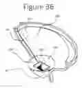 Fig. 06 - Methods and systems for adaptive treatment of disorders in the gastrointestinal tract
