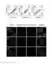 Fig. 06 - Preparation and application of novel multifunctional nanocomposite material with new photosensitizer