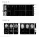 Fig. 04 - Curcumin derivative, method for producing same, and photo-acoustic imaging agent comprising same for detecting beta-amyloid plaque
