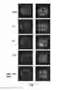 Fig. 02 - Biocompatible polymeric nanoparticles containing functional metal nanostructures, preparation processes, and related uses in diagnostic and/or therapeutic fields