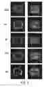 Fig. 04 - Biocompatible polymeric nanoparticles containing functional metal nanostructures, preparation processes, and related uses in diagnostic and/or therapeutic fields