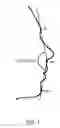 Fig. 02 - IMPLANTS FOR SCULPTING, AUGMENTING OR CORRECTING FACIAL FEATURES SUCH AS THE CHIN