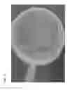 Fig. 06 - METHODS AND POLYMER COMPOSITIONS FOR TREATING RETINAL DETACHMENT AND OTHER OCULAR DISORDERS
