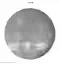 Fig. 09 - METHODS AND POLYMER COMPOSITIONS FOR TREATING RETINAL DETACHMENT AND OTHER OCULAR DISORDERS