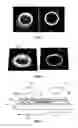 Fig. 02 - Article with dynamic frame formed with aligned pigment flakes