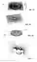 Fig. 07 - Article with dynamic frame formed with aligned pigment flakes