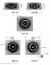 Fig. 17 - Article with dynamic frame formed with aligned pigment flakes