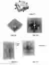 Fig. 20 - Article with dynamic frame formed with aligned pigment flakes