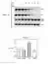 Fig. 02 - Treatment for glaucoma and other eye diseases