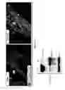 Fig. 09 - Treatment for glaucoma and other eye diseases