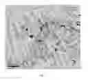 Fig. 02 - HYPEREUTECTOID RAIL AND MANUFACTURING METHOD THEREOF