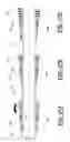 Fig. 22 - Drill string mountable wellbore cleanup apparatus and method