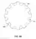 Fig. 09 - Buoyancy-enhanced helical loop drive system