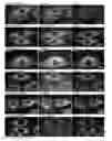 Fig. 01 - IRIDIUM COMPLEXES FOR CELLULAR IMAGING