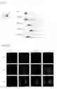 Fig. 07 - Method for screening antibody using patient-derived tumor spheroids