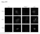 Fig. 08 - Method for screening antibody using patient-derived tumor spheroids