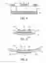 Fig. 04 - Co-planar RF coil feeding