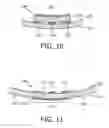 Fig. 07 - Co-planar RF coil feeding