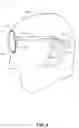 Fig. 10 - Flexible temples for glasses frames