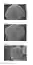 Fig. 02 - Crash cooling method to prepare toner