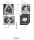 Fig. 08 - INTERACTIVE 3D CURSOR FOR USE IN MEDICAL IMAGING