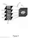 Fig. 09 - INTERACTIVE 3D CURSOR FOR USE IN MEDICAL IMAGING