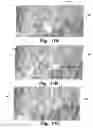 Fig. 09 - Breathing apparatus having a display with user selectable background