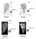 Fig. 02 - System and method for estimating a quantity of interest based on an image of a histological section