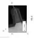 Fig. 08 - Anomaly detection using image-based physical characterization