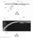Fig. 07 - Method and apparatus for guiding an electromagnetic wave to a transmission medium