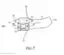 Fig. 07 - Non-occluding feedback-resistant hearing device