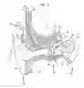 Fig. 02 - Removable attachment of a passive transcutaneous bone conduction device with limited skin deformation