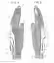 Fig. 05 - Glove for conforming to hands of various sizes