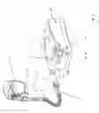 Fig. 02 - System for recording the breathing efforts of a patient