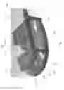 Fig. 02 - Dynamic ligament balancing system with pin positioning block