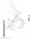 Fig. 06 - Apparatus, system and method for medical analyses of seated individual