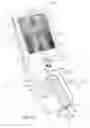 Fig. 02 - Tactile sensing and needle guidance device