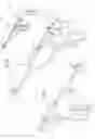 Fig. 08 - ARTHROSCOPIC SURGICAL DEVICE