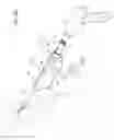 Fig. 63 - ARTHROSCOPIC SURGICAL DEVICE