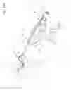 Fig. 76 - ARTHROSCOPIC SURGICAL DEVICE
