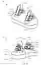 Fig. 02 - Arthroplasty prostheses with multi-axis fixation