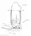 Fig. 01 - PROSTHETIC FOOT, AND PROSTHESIS FOR A LOWER EXTREMITY