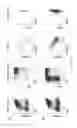 Fig. 03 - Methods of generating T-cells from stem cells and immunotherapeutic methods using the T-cells