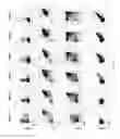 Fig. 05 - Methods of generating T-cells from stem cells and immunotherapeutic methods using the T-cells