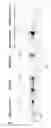 Fig. 14 - Methods of generating T-cells from stem cells and immunotherapeutic methods using the T-cells