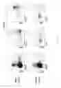 Fig. 76 - Methods of generating T-cells from stem cells and immunotherapeutic methods using the T-cells