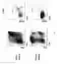Fig. 80 - Methods of generating T-cells from stem cells and immunotherapeutic methods using the T-cells