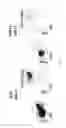 Fig. 83 - Methods of generating T-cells from stem cells and immunotherapeutic methods using the T-cells