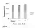 Fig. 09 - Reagents and methods for treating bacterial infection